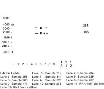 Figure 2.9 - Experion gel data RNA from Human post-m ortem  brain tissue 