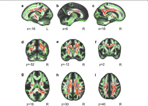 Fig. 1 Decreased Mean Diffusivity values of WM tracts across the whole brain in PKU as compared with controls