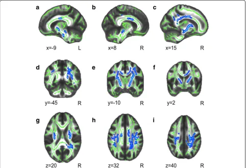 Fig. 2 Decreased Radial Diffusivity values of WM tracts acress the whole brain in PKU as compared with controls