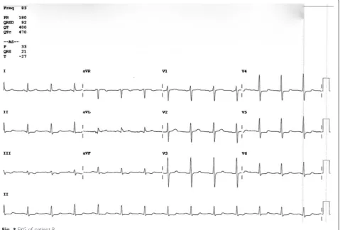 Fig. 3 EKG of patient B