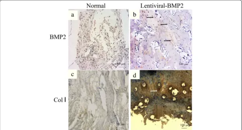 Figure 7 Human derived OCN was detected by immunostaining after six weeks. (a) USCs/β-TCP; (b) Lentiviral-BMP2 transduced USCs/β-TCP.The arrows indicate the positive staining of OCN