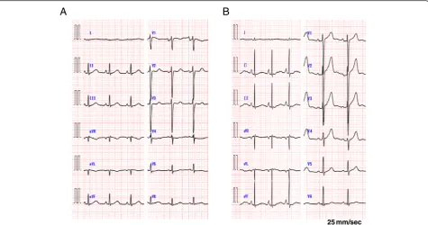 Fig. 1 Electrocardiogram on admission showed slightly low voltage, poor progression R wave and ST segment depression in leads V4-5 (a)