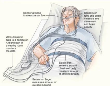 Fig. 2. Polysomnography test for sleep disorder. 