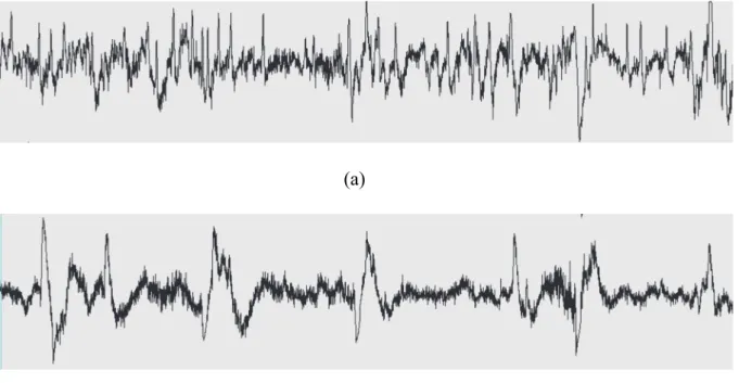 Fig. 5. In wakefulness, (a) EEG (beta wave) (b) relaxed wakefulness EOG.   