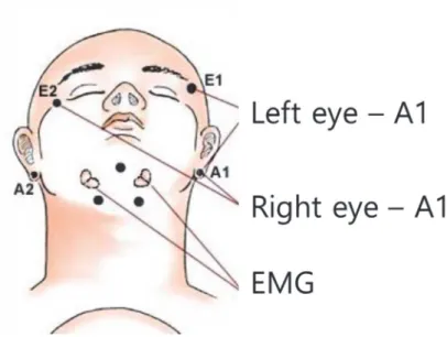 Fig. 11. Electrode placement for EOG and EMG. 