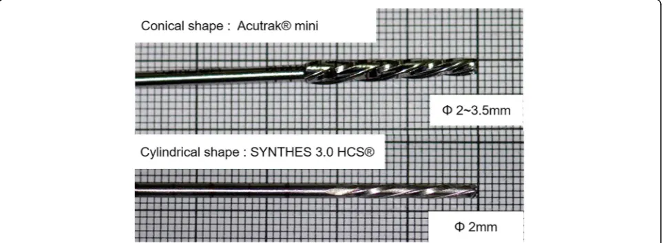 Fig. 1 The Acutrak® mini drill bit has a conical type, where the diameter increases from 2.0 mm to 3.5 mm from the leading end to the trailing end.The Synthes 3.0 HCS® drill bit has a cylindrical type with a constant diameter of 2.0 mm