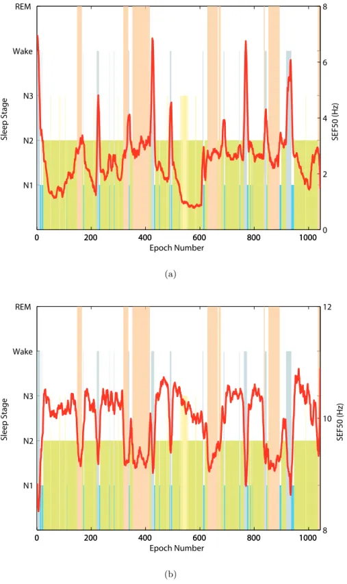 Figure 4.3: Hypnogram and SEF50 in the (a) 0.5-50 Hz and (b) 8-16 Hz band of the EEG signal for one training subject.