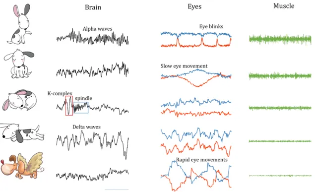 Figure 1.2. This figure shows examples of the EEG, EOG and EMG signals in the  different sleep stages (from top to bottom: Wake, Stage 1, 2, 3, REM)