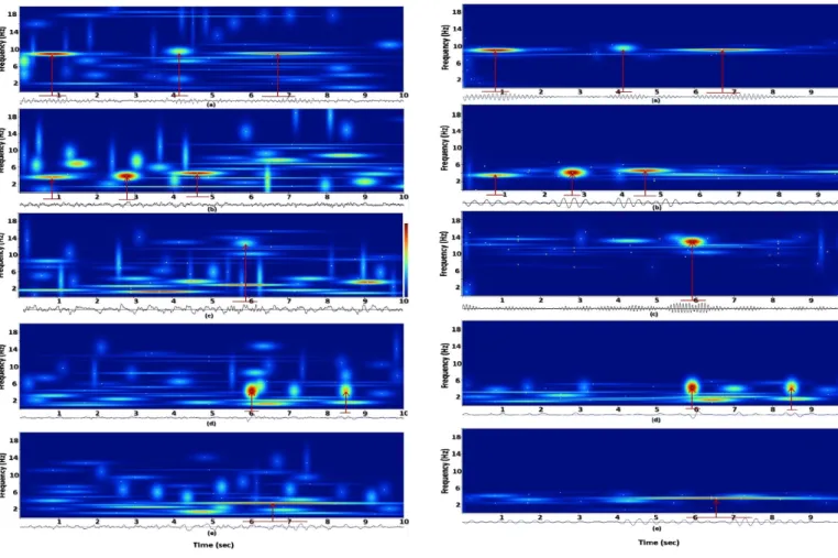 Figure 3: T-F representation of different sleep EEG stages of the same subject as in Figure 2 using the proposed constrained SSA; (a) awake, marked alpha; (b) N1, marked theta; (c) N2, spindle; (d) N2 K-complex; and (e) SWS.