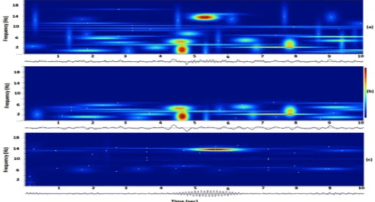 Figure 4: Separation of k-complex and sleep spindle from sleep EEG signal; (a) original signal, (b) the extracted k-complex, (c) the  ex-tracted sleep spindle