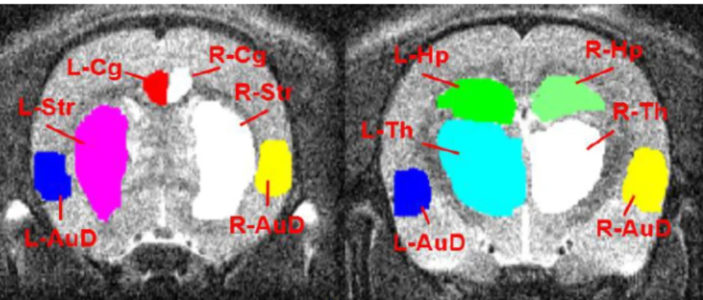 Figure 3.11: ROI drawing of the rat 3 of 21/03/2016 and 22/03/2016 Seizure dataset