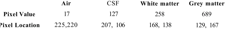 Table 5.5Details of the initial estimate of the four classes' centroids for the T2 weighted image