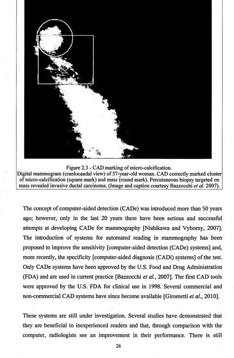 Figure 2.3 - CAD marking of micro-calcification.