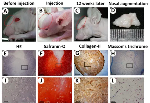 Figure 7 B-CB-P grafts enabled stable nasal augmentation in vivo. (A to D) Nasal augmentation regenerated by cell brick-enriched PRP gelcomposited with BMSCs