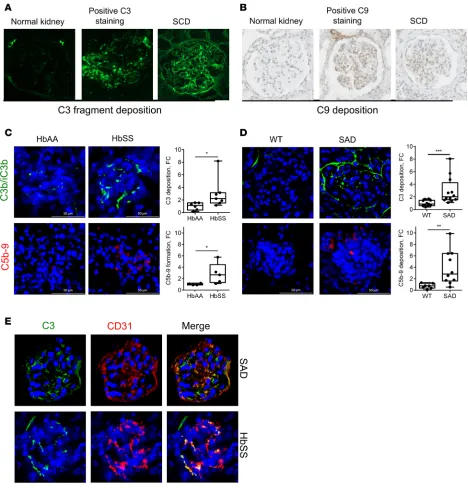 Figure 1. Patients suffering from SCD nephropathy and SCD mice have complement deposition within kidneys