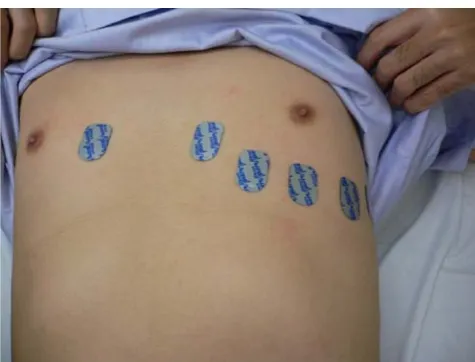 Fig. 1 The V-Quick patch placement system