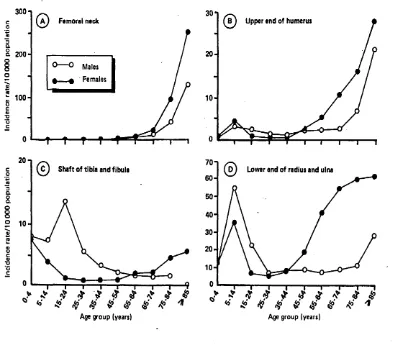 Figure 2: Fracture incidence by type of fracture in UK (Donaldson et al. 1990).
