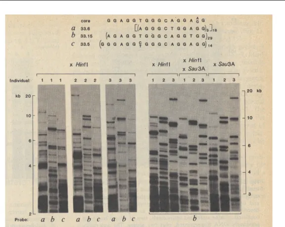 Figure 2.8: A example of a Southern Blot. Taken from Je ffreys et al. [1985] article in Nature