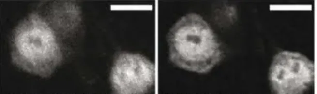 Figure 4. Adaptive optics in microscopy 