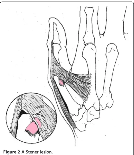 Figure 1 Anatomy of the ACL and PCL.