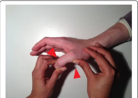 Figure 4 Testing of the UCL with MCP in flexion.