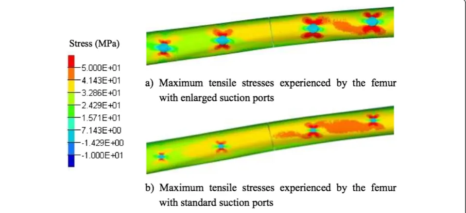 Figure 4 A comparison of maximum compressive stresses throughout the femur for the stance phase of walking.