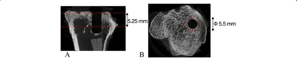 Figure 2 Micro-CT regions of interest. (A) 5.25 mm was analyzed by drawing a (B) 5.5-mm circular region of interest