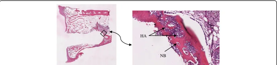 Figure 4 Histology slides showing the bone integration. Histology slides showing the bone integration at week 6 in the prosthesis fixed withCerament™ (original magnification ×1 (left) and ×20 (right)) in the distal part of the prosthesis