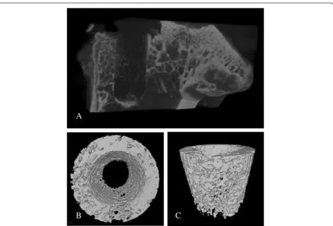 Figure 5 Micro-CT images. Micro-CT 3D rendering of the proximal tibia (A), and the bone within a 5.5-mm-diameter region (B, C) showinghigh bone contact with smooth surface in both groups both after 6 and 12 weeks