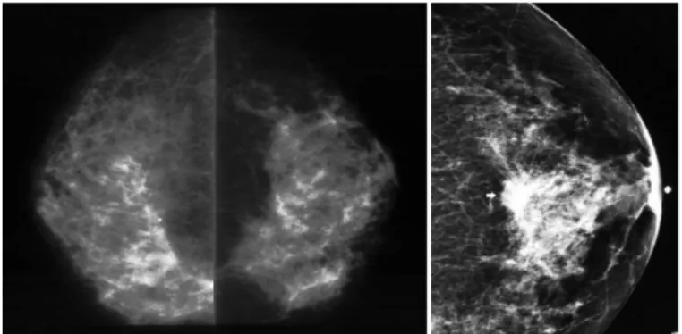 Fig. 2. Mammographs.