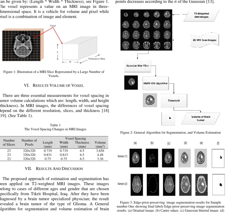 Figure 1: Illustration of a MRI Slice Represented by a Large Number of  Voxels. 