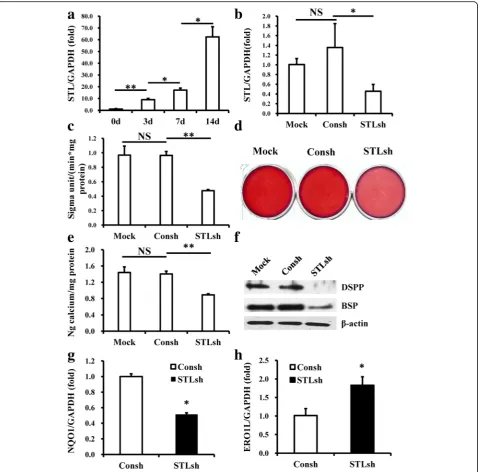 Fig. 6 Knockdown of the lncRNA STL inhibited the osteo/odontogenic differentiation potential of DPSCs in vitro.ANOVA and Studentstaining (DSPP in DPSCs after osteo/odontogenic induction.(during osteo/odontogenic differentiation of DPSCs evaluated by real-t