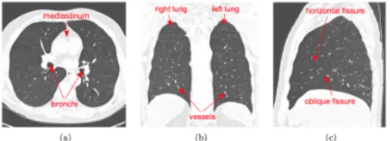 Fig. 1.2 An example of a CT scan of the lungs with some anatomical structures underlined.