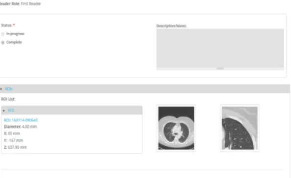 Fig. 2.2 Overview of the annotation module with an example of selected ROI. Screenshot on the left is the global axial view of the slice corresponding to the finding, while the screenshot on the right is the cropped zoomed view of the finding