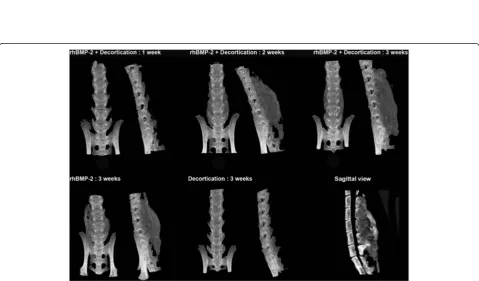Figure 2 Three-dimensional reconstructions of CT images demonstrating the anatomy of murine lumbar spine (left) vs human lumbarprocess of the mouse spine differs significantly from the human spine