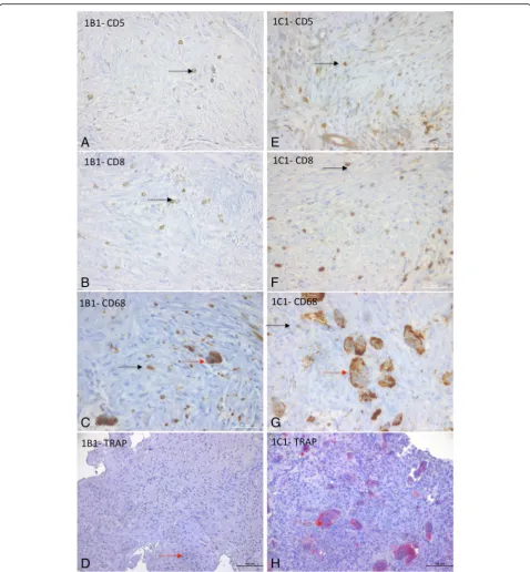 Fig. 2 Characterization of cells present in cherubism granulomas (CD5, CD8, CD68, TRAP activity)