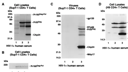 FIG. 3. Defect in proteolytic processing of HIV-1 Gag precursors in Myr�Materials and Methods