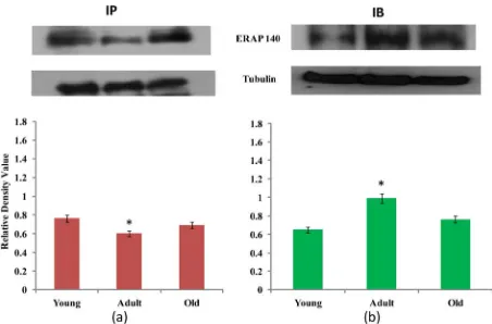 Figure 1. (a) Immunoprecipitation (IP) of nuclear extract from one-way ANOVA comparing age, followed by all pairwise mul- tiple comparison procedure (Student-Newmann-Keuls method)