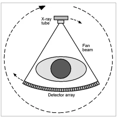 Figure 7: Fan-Beam computed tomography. 
