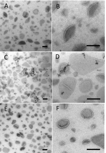 Fig. 2. Comparison of single UA stain with mixed double stains on liposomes adsorbed to EM support ﬁlms