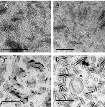 Fig. 4. Bicelles. Bicelles were adsorbed to EM supportThe smaller structures are di ﬁlms at 22°C and stained using (A) UA alone (classic negative stain), (B) UA in MC, (C) PTA in MC and (D) UA/PTA mixture in MC.ﬃcult to discern in (A) and (B) and undergo c
