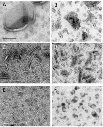 Fig. 6. Double staining in sequence. Uranyl acetate and PTA in MC were applied sequentially as described in the methods after absorption of liposomes (A and B), bicelles (C and D) andnanodiscs (E and F)