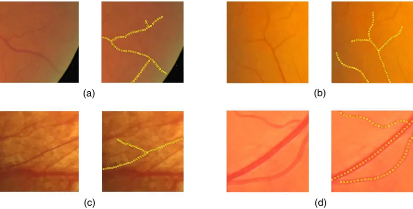 Fig. 9 Sample vessel tracking and bifurcations detection in retinal images. The original images (left) andtheir corresponding results (right) in: (a, b) narrow vessels, (c) noisy images, and (d) vessels withreflections.