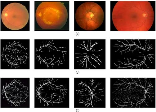 Fig. 11 Sample segmented results of retinal images from the DRIVE, STARE, CHASEDB1, and HRFdatabases using the proposed method: (a) the original images, (b) the corresponding obtained segmen-tations, and (c) the manual segmentations.