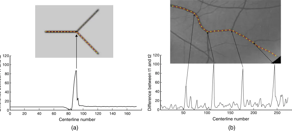 Fig. 6 Examples of vessel tracking and diameter estimation areshown: (a) tracking a simple vessel fragment (extracted from DRIVEdata sets) with no bifurcation and (b) tracking diameter variability ina synthetic vessel fragment.
