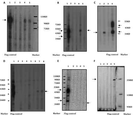 FIG 2 (A to F) Western blot analysis results for serum samples using a multichannel protein screening device (Bio-Rad)
