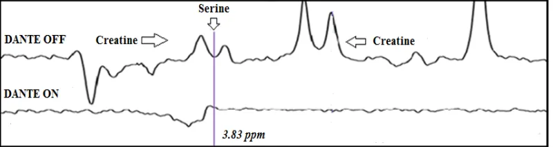 Figure 2-7. Top spectrum displays a conventional MRS in vivo data 
