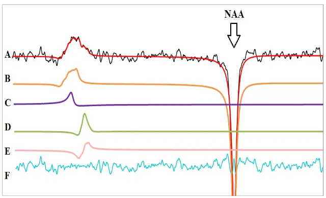 Figure 2-8. Representative in vivo spectrum obtained from the left 