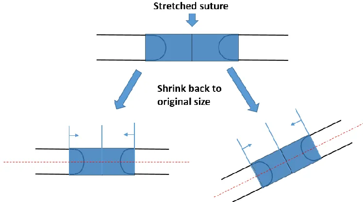 Figure 2.21: The suture shrink back to normal size along the direction of the tension 