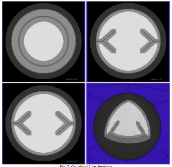 Fig. 8. Phantom (right) derived from a sample slice of the corpus callosum [10] (left)